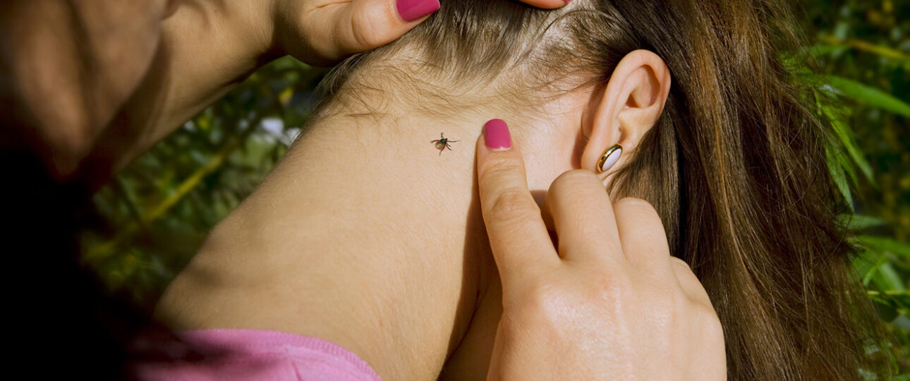 Що робити, якщо вас укусив кліщ Що робити, якщо вас укусив кліщ