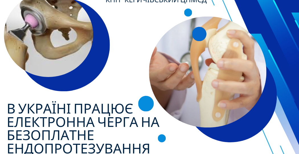 В Україні працює електронна черга на безоплатне ендопротезування